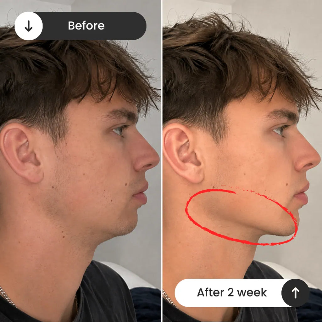 Peptide Jawline Sculpting System
