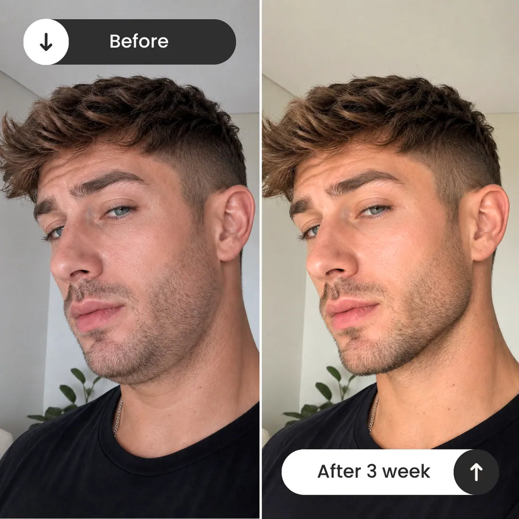 Peptide Jawline Sculpting System