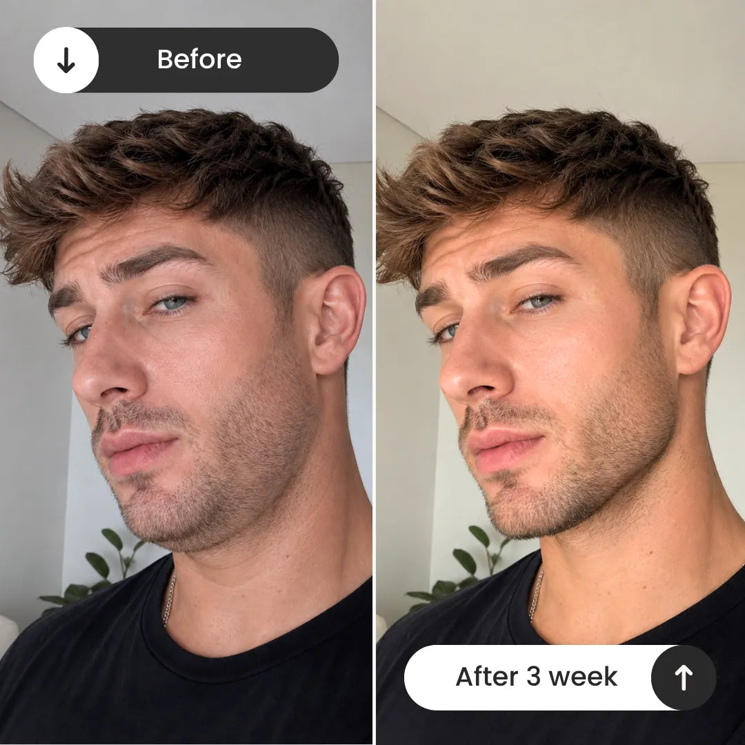 Peptide Jawline Sculpting System